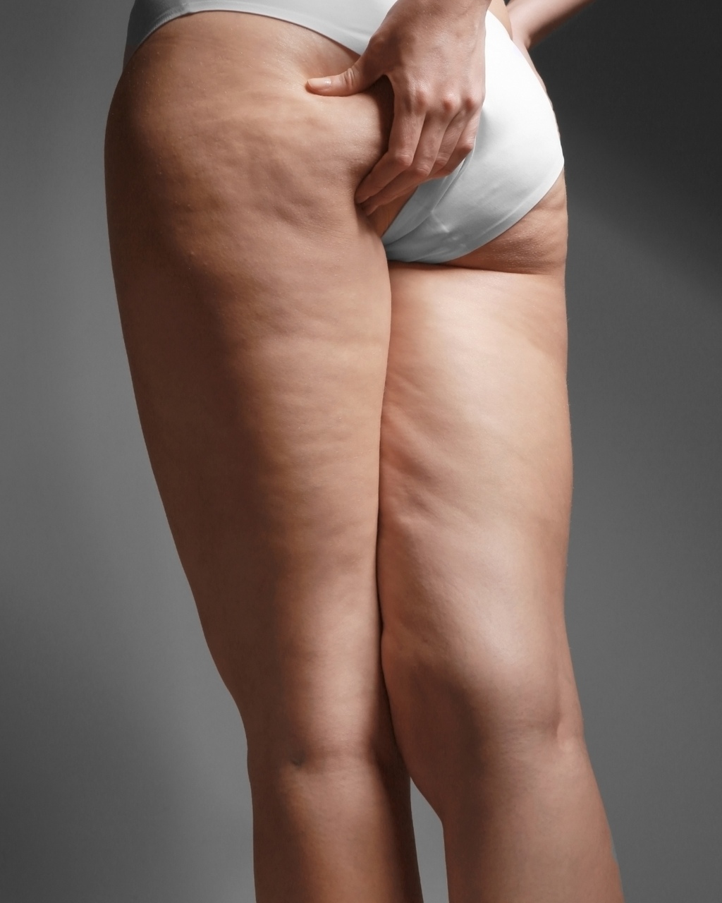 Lipedema_Easy-Resize.com_ Notícias