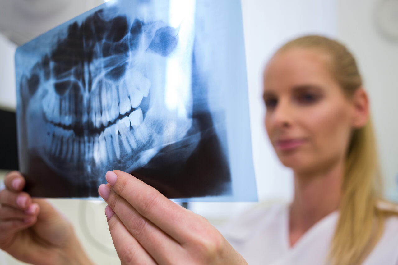 dentist-looking-dental-x-ray-plate_Easy-Resize.com-1 Notícias