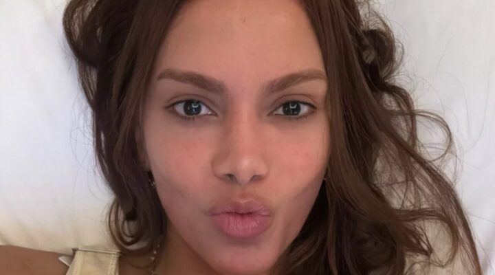 É preciso empatia”, é o que afirma Dra Silvia Zimbres sobre novo visual de Anitta