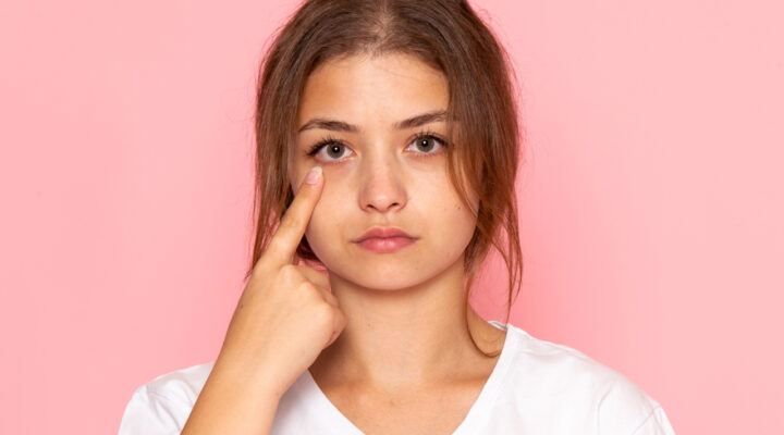 Olheiras: genética, cansaço ou estilo de vida? Saiba o que realmente causa o problema