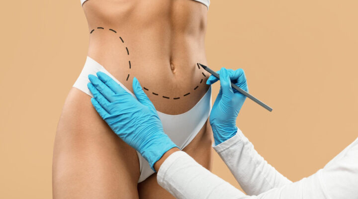 SBCP- Belo Horizonte sedia o 61º Congresso Brasileiro de Cirurgia Plástica